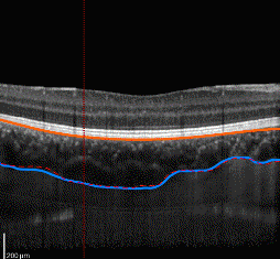 Anisotropia  IMAGENS MÉDICAS: TÓPICOS EM ENGENHARIA BIOMÉDICA